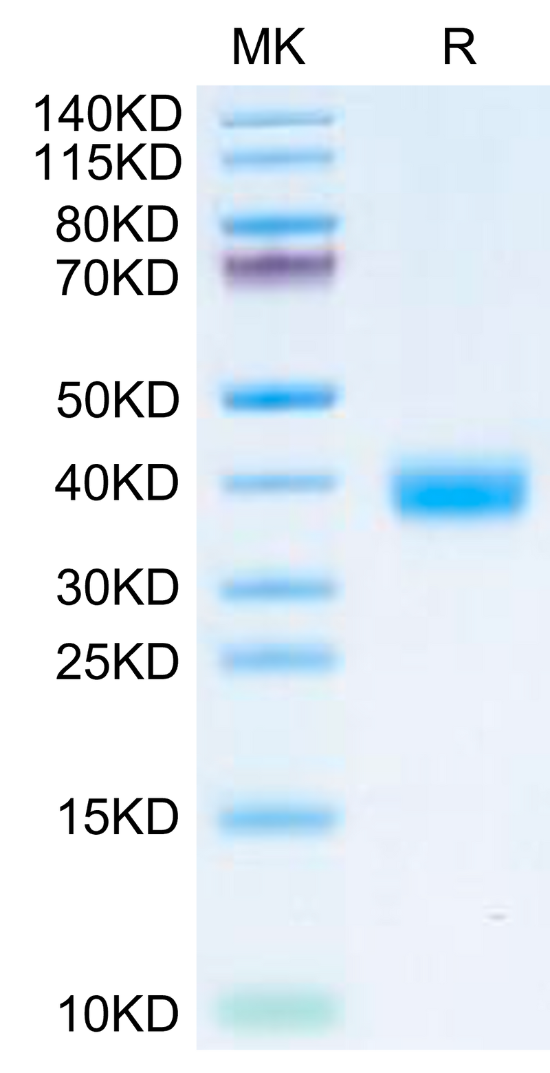 SARS-CoV-2 Spike RBD (Omicron BF.7/BA.4.6) on Tris-Bis PAGE under reduced condition. The purity is greater than 95%.Recombinant SARS-CoV-2 Spike RBD (Omicron BF.7/BA.4.6) Protein, Active
