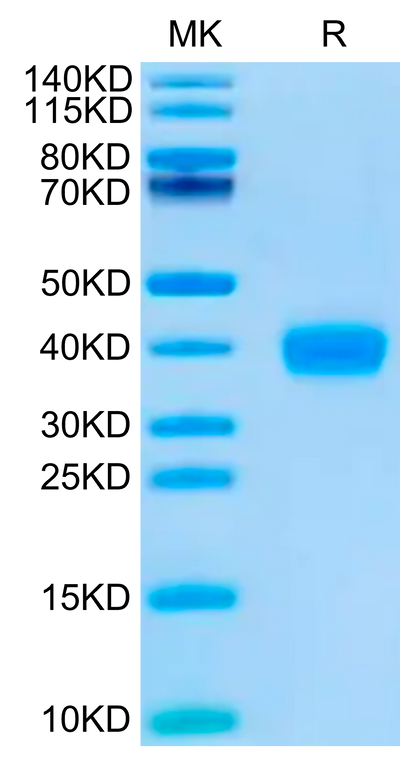 SARS-CoV-2 Spike RBD (Omicron BQ.1.1) on Tris-Bis PAGE under reduced condition. The purity is greater than 95%.Recombinant SARS-CoV-2 Spike RBD (Omicron BQ.1.1) Protein, Active