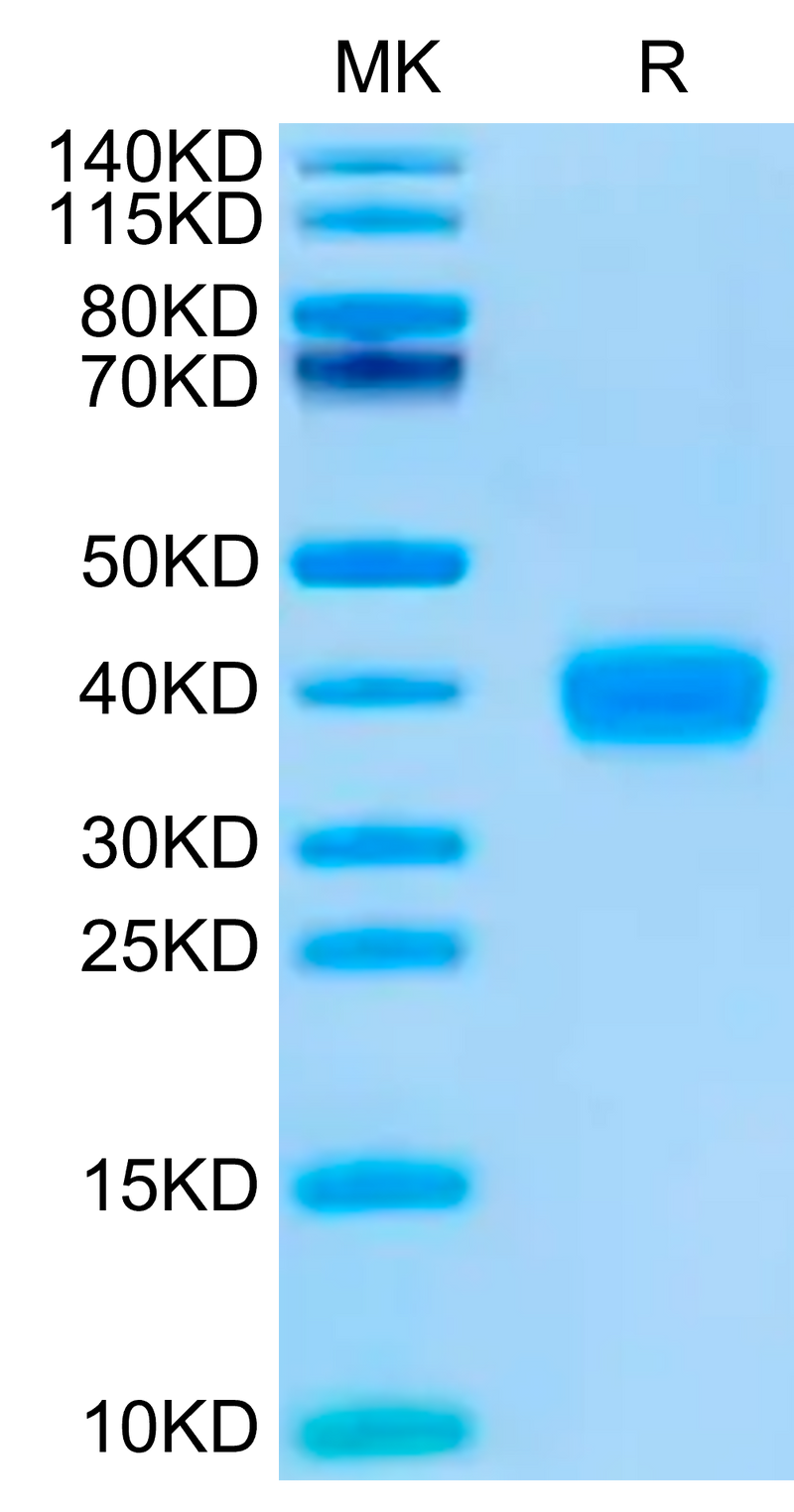 SARS-CoV-2 Spike RBD (Omicron BQ.1.1) on Tris-Bis PAGE under reduced condition. The purity is greater than 95%.Recombinant SARS-CoV-2 Spike RBD (Omicron BQ.1.1) Protein, Active