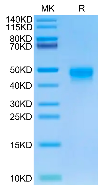 Human DKK1 on Tris-Bis PAGE under reduced condition. The purity is greater than 95%.Recombinant Human DKK1 Protein, Active