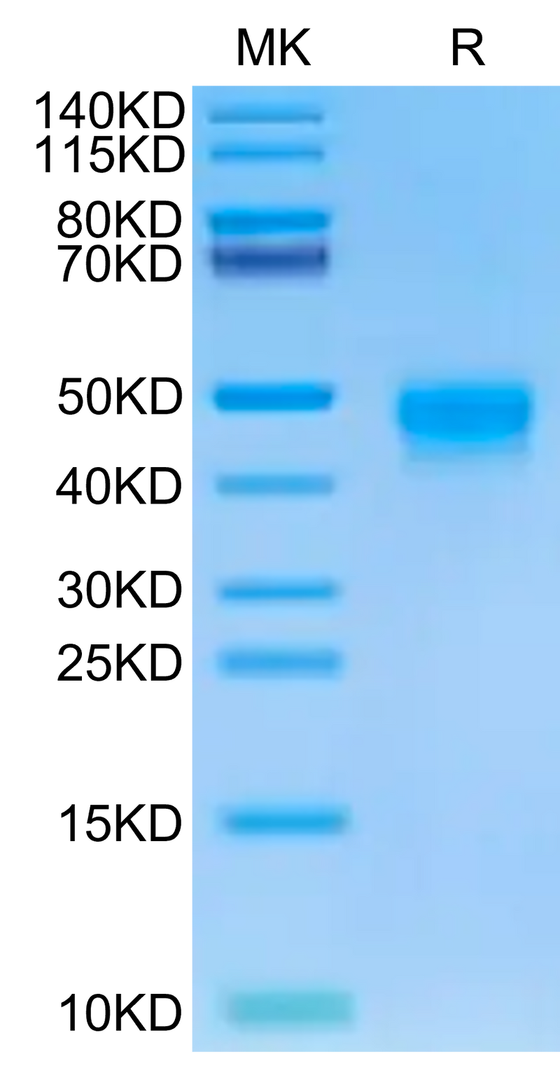 Human DKK1 on Tris-Bis PAGE under reduced condition. The purity is greater than 95%.Recombinant Human DKK1 Protein, Active
