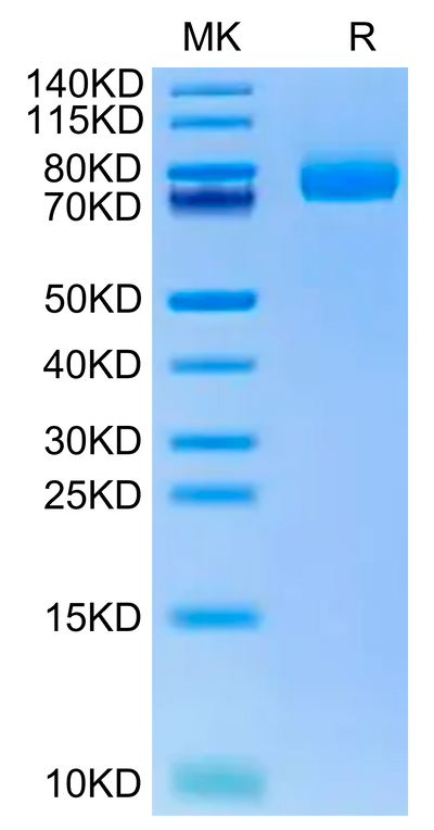 Human CD36 on Tris-Bis PAGE under reduced condition. The purity is greater than 95%.Recombinant Human CD36/SR-B3 Protein