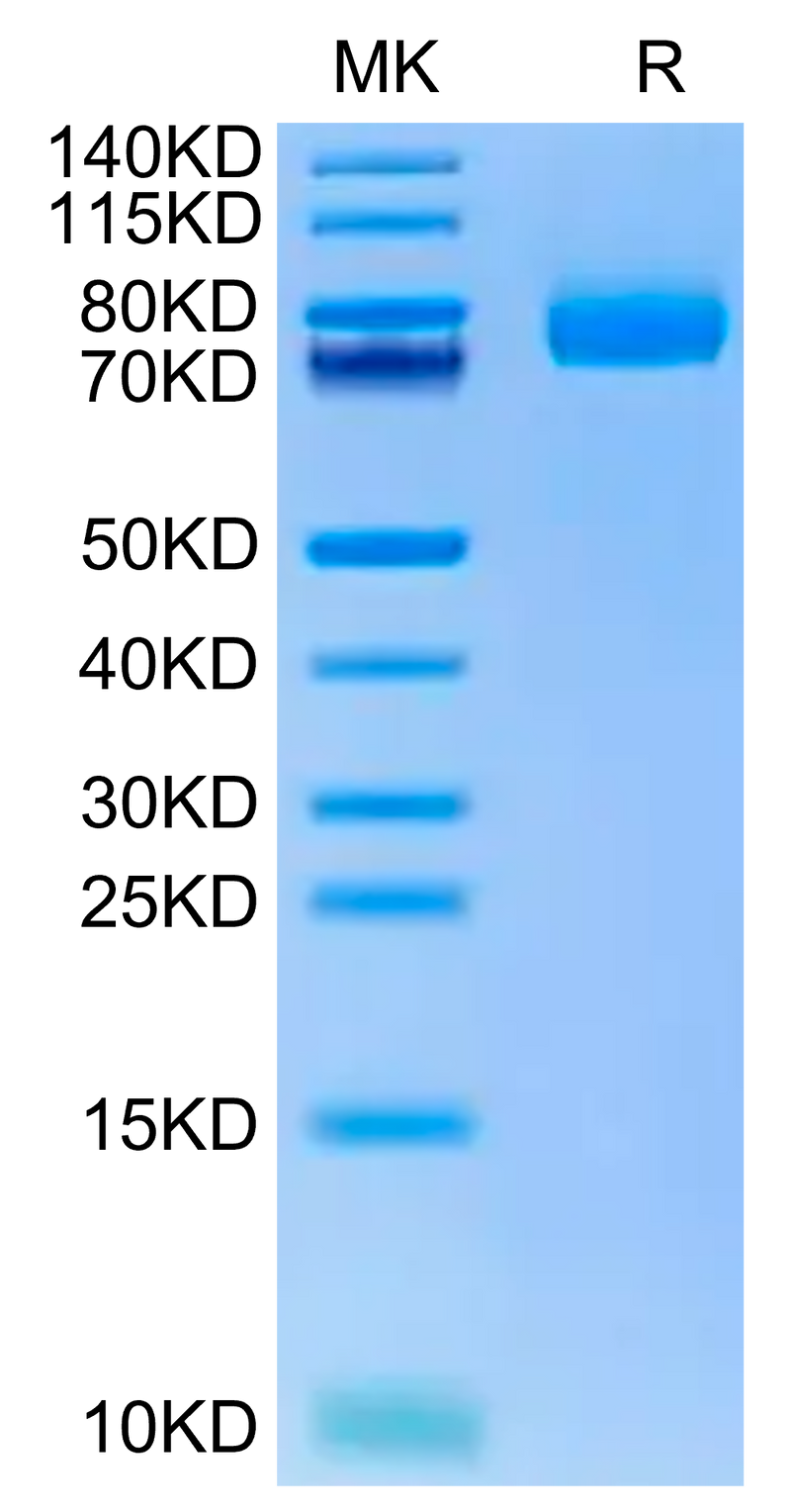 Human CD36 on Tris-Bis PAGE under reduced condition. The purity is greater than 95%.Recombinant Human CD36/SR-B3 Protein