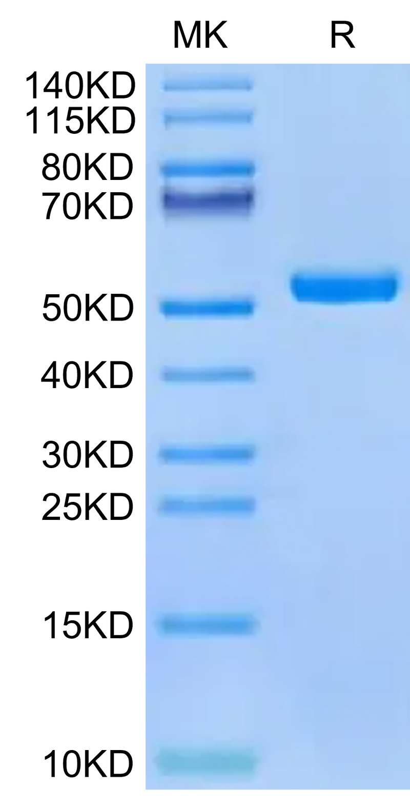 Human HLA-A*02:01&B2M&PRAME (SLLQHLIGL) Monomer on Tris-Bis PAGE under reduced condition. The purity is greater than 95%.Recombinant Human HLA-A*02:01&B2M&PRAME (SLLQHLIGL) Monomer Protein