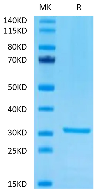 Mouse PLAU on Tris-Bis PAGE under reduced condition. The purity is greater than 95%.Recombinant Mouse PLAU/uPA Protein, Active