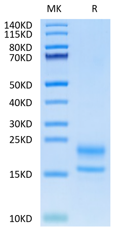 Human VEGF121 on Tris-Bis PAGE under reduced condition. The purity is greater than 95%.Recombinant Human VEGF121 Protein, Active