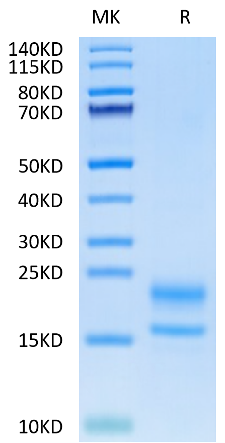 Human VEGF121 on Tris-Bis PAGE under reduced condition. The purity is greater than 95%.Recombinant Human VEGF121 Protein, Active