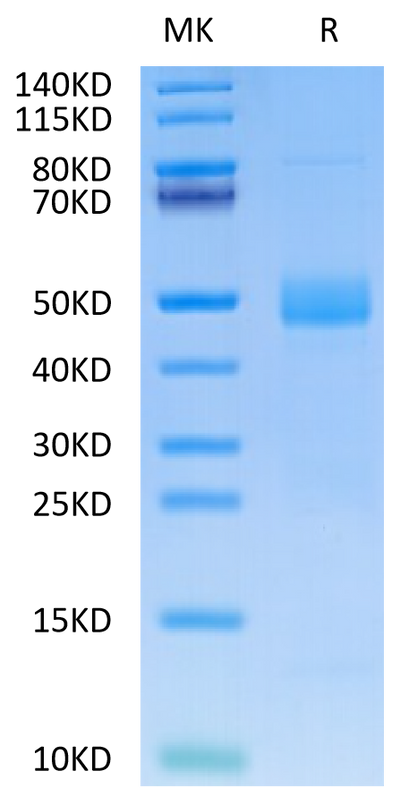 Human CTGF on Tris-Bis PAGE under reduced condition. The purity is greater than 95%.Recombinant Human CTGF/CCN2 Protein, Active