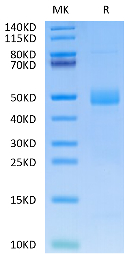 Human CTGF on Tris-Bis PAGE under reduced condition. The purity is greater than 95%.Recombinant Human CTGF/CCN2 Protein, Active