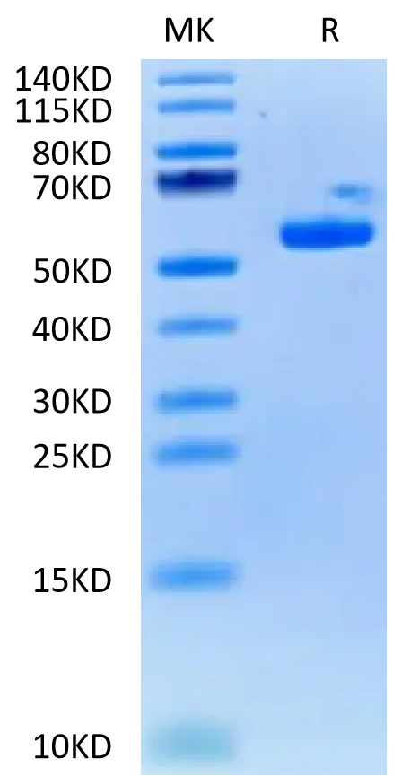 Biotinylated Human HLA-A*03:01&B2M&KRAS G12V (VVVGAVGVGK) Monomer on Tris-Bis PAGE under reduced condition. The purity is greater than 95%.Biotinylated Human HLA-A*03:01&B2M&KRAS G12V (VVVGAVGVGK) Monomer Protein, Active