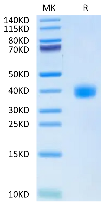 SARS-CoV-2 Spike RBD (Omicron BA.2.38) on Tris-Bis PAGE under reduced condition. The purity is greater than 95%.Recombinant SARS-CoV-2 Spike RBD (Omicron BA.2.38) Protein, Active