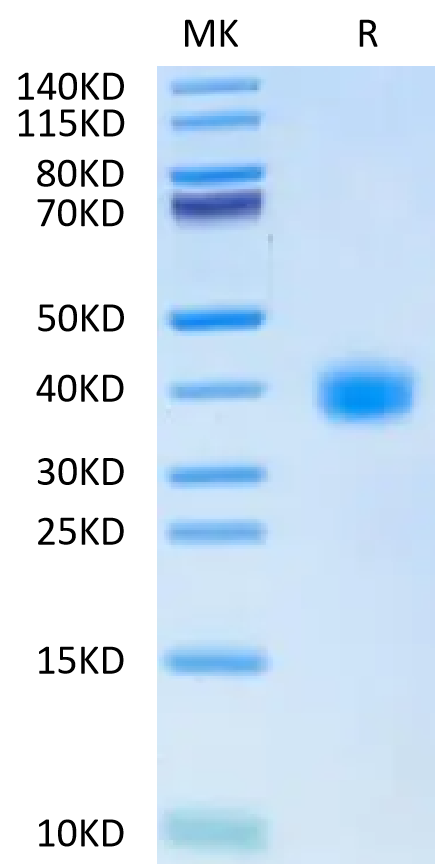 SARS-CoV-2 Spike RBD (Omicron BA.2.38) on Tris-Bis PAGE under reduced condition. The purity is greater than 95%.Recombinant SARS-CoV-2 Spike RBD (Omicron BA.2.38) Protein, Active
