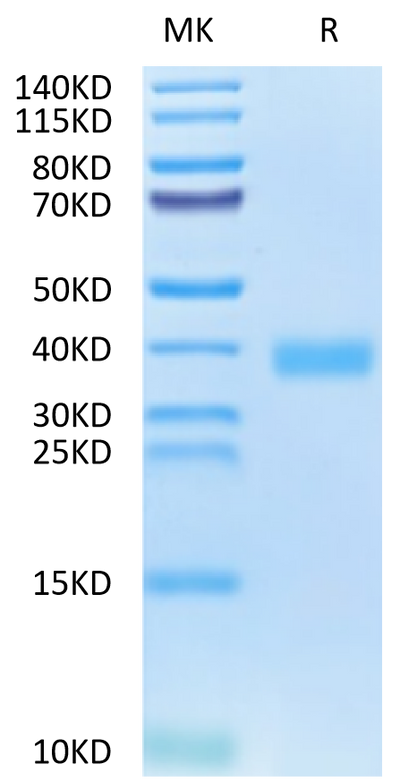SARS-CoV-2 Spike RBD (Omicron BA.2.74) on Tris-Bis PAGE under reduced condition. The purity is greater than 95%.Recombinant SARS-CoV-2 Spike RBD (Omicron BA.2.74) Protein, Active