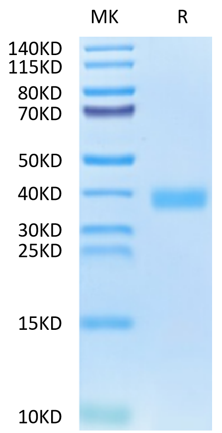 SARS-CoV-2 Spike RBD (Omicron BA.2.74) on Tris-Bis PAGE under reduced condition. The purity is greater than 95%.Recombinant SARS-CoV-2 Spike RBD (Omicron BA.2.74) Protein, Active