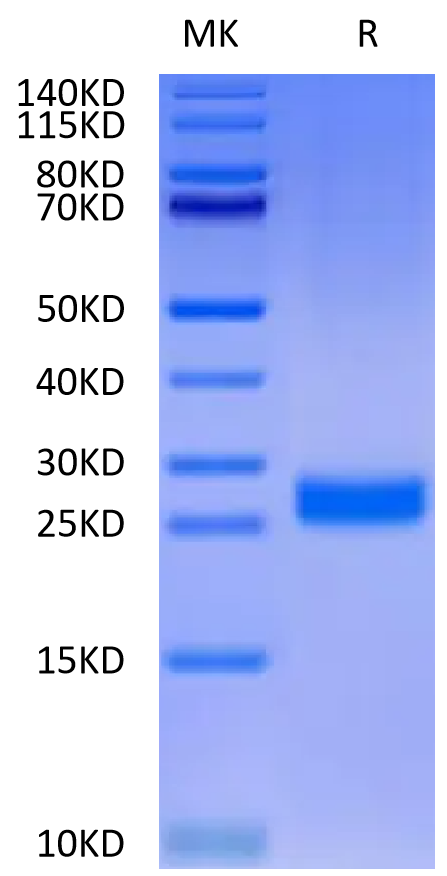 Human DLL3 Domain (311-479) on Tris-Bis PAGE under reduced condition. The purity is greater than 95%.Recombinant Human DLL3 Domain (311-479) Protein, Active