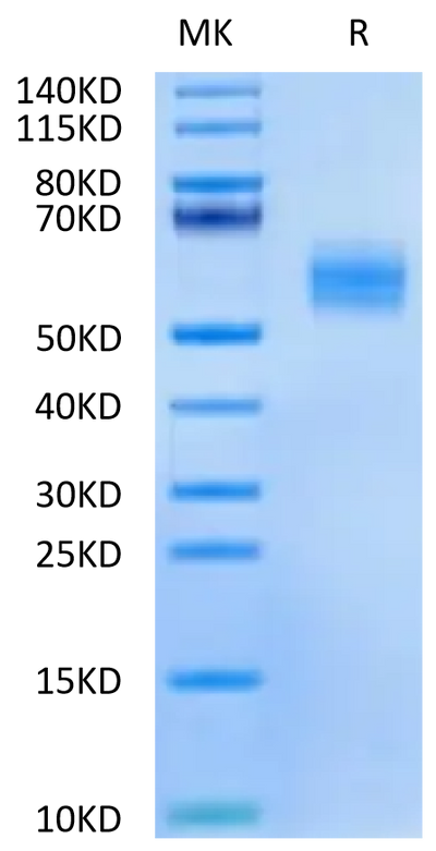Mouse LTK on Tris-Bis PAGE under reduced condition. The purity is greater than 95%.Recombinant Mouse LTK Potein