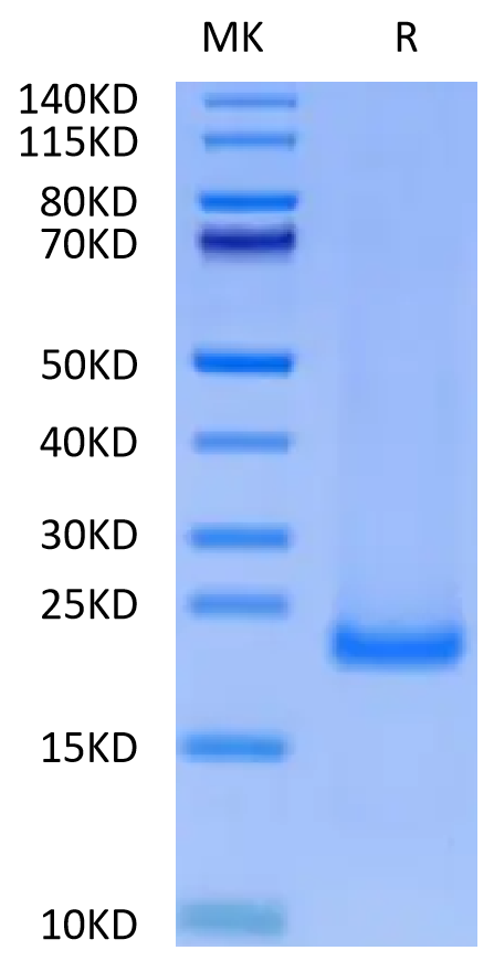 Cynomolgus MD2 on Tris-Bis PAGE under reduced condition. The purity is greater than 95%.Recombinant Cynomolgus MD2 Protein