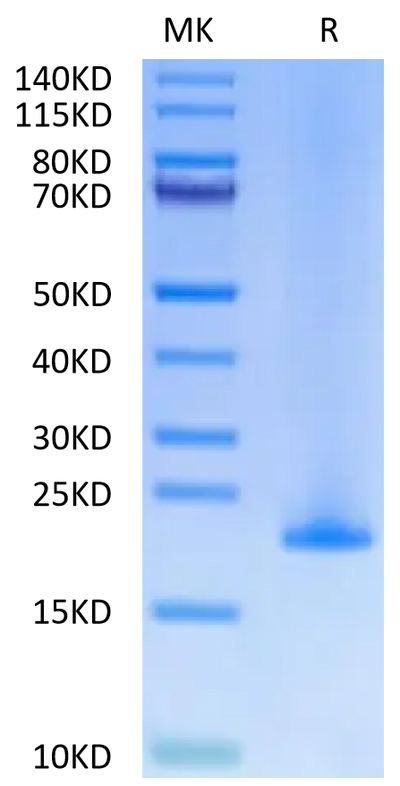 Human MD2 on Tris-Bis PAGE under reduced condition. The purity is greater than 95%.Recombinant Human MD2 Protein