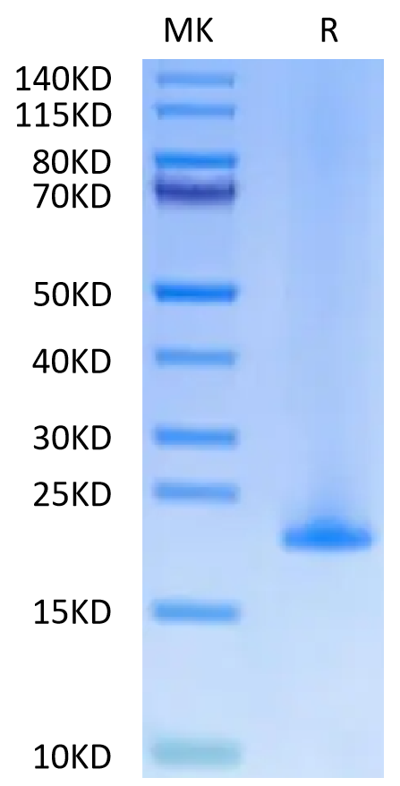 Human MD2 on Tris-Bis PAGE under reduced condition. The purity is greater than 95%.Recombinant Human MD2 Protein