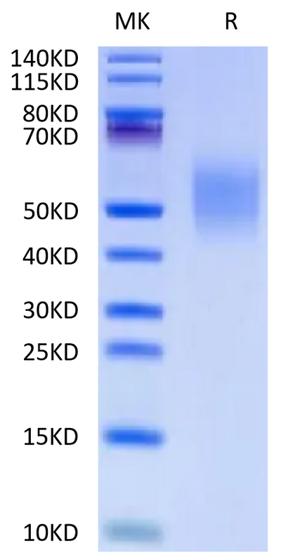 Human CD44 on Tris-Bis PAGE under reduced condition. The purity is greater than 95%.Recombinant Human CD44 Protein, Active