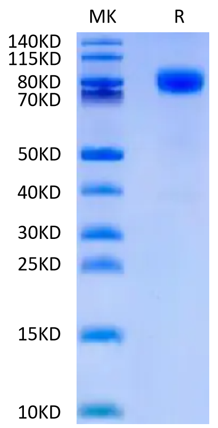 Human CD44 on Tris-Bis PAGE under reduced condition. The purity is greater than 95%.Recombinant Human CD44 Protein, Active