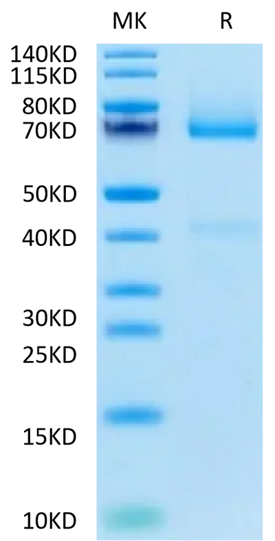 Biotinylated Human GPC3 on Tris-Bis PAGE under reduced condition. The purity is greater than 90%.Biotinylated Human GPC3/Glypican 3 Protein, Active