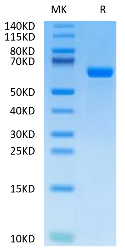 Human Alkaline Phosphatase (Germ type) on Tris-Bis PAGE under reduced condition. The purity is greater than 95%.Recombinant Human Alkaline Phosphatase (Germ type) /ALPG Protein, Active