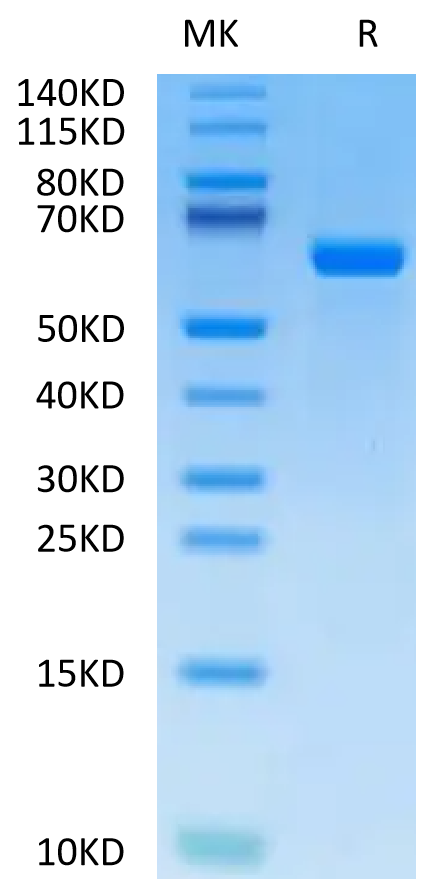 Human Alkaline Phosphatase (Germ type) on Tris-Bis PAGE under reduced condition. The purity is greater than 95%.Recombinant Human Alkaline Phosphatase (Germ type) /ALPG Protein, Active