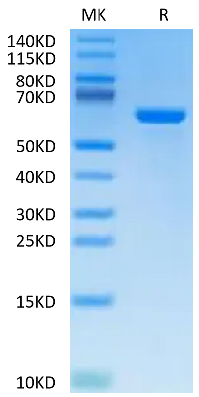 Cynomolgus Alkaline Phosphatase (Placental type) on Tris-Bis PAGE under reduced condition. The purity is greater than 95%.Recombinant Cynomolgus Alkaline Phosphatase (Placental type) /ALPP Protein, Active