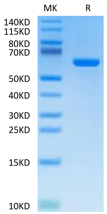 Cynomolgus Alkaline Phosphatase (Placental type) on Tris-Bis PAGE under reduced condition. The purity is greater than 95%.Recombinant Cynomolgus Alkaline Phosphatase (Placental type) /ALPP Protein, Active