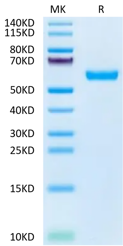 Human IGF2R Domain 1-3 on Tris-Bis PAGE under reduced condition. The purity is greater than 95%.Recombinant Human IGF2R Domain 1-3 Protein