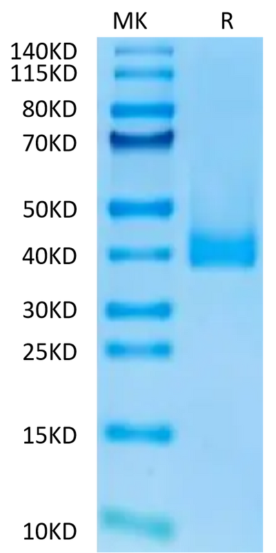 Cynomolgus CCR8 on Tris-Bis PAGE under reduced condition. The purity is greater than 95%.Recombinant Cynomolgus CCR8 Protein, Active