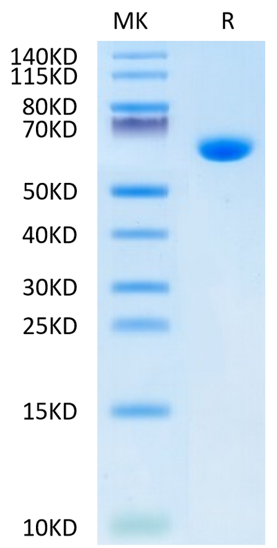 Mouse Alkaline Phosphatase (Germ type) on Tris-Bis PAGE under reduced condition. The purity is greater than 95%.Recombinant Mouse Alkaline Phosphatase (Germ type) /ALPG Protein
