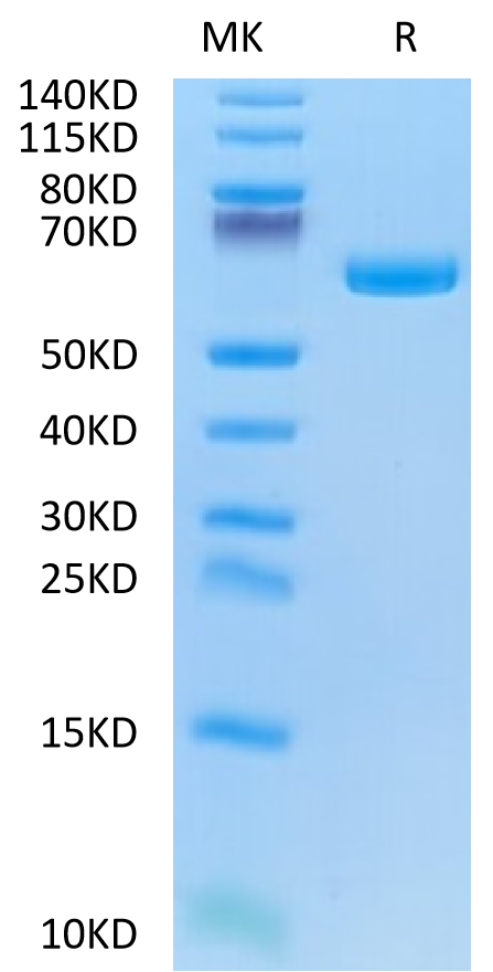 Biotinylated Human Alkaline Phosphatase (Germ type) on Tris-Bis PAGE under reduced condition. The purity is greater than 95%.Biotinylated Human Alkaline Phosphatase (Germ type) /ALPG Protein, Active