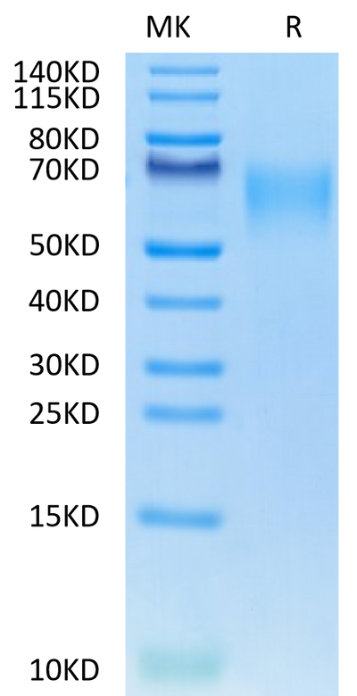 Mouse TPBG on Tris-Bis PAGE under reduced condition. The purity is greater than 95%.Recombinant Mouse TPBG/5T4 Protein