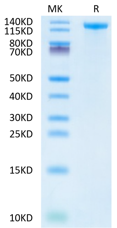 Human Jagged 1 on Tris-Bis PAGE under reduced condition. The purity is greater than 95%.Recombinant Human Jagged 1/JAG1 Protein