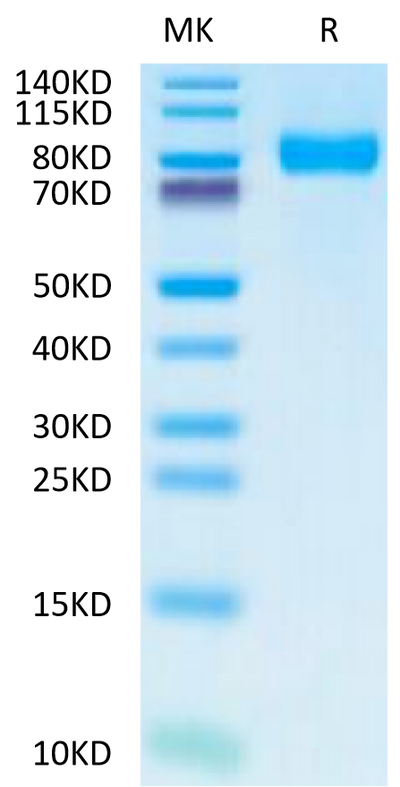 Human TPBG on Tris-Bis PAGE under reduced condition. The purity is greater than 95%.Recombinant Human TPBG/5T4 Protein, Active
