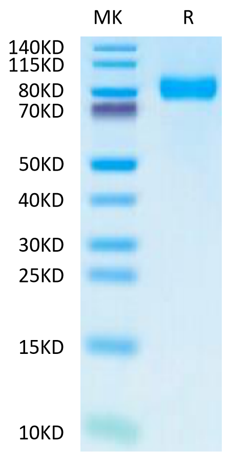 Human TPBG on Tris-Bis PAGE under reduced condition. The purity is greater than 95%.Recombinant Human TPBG/5T4 Protein, Active
