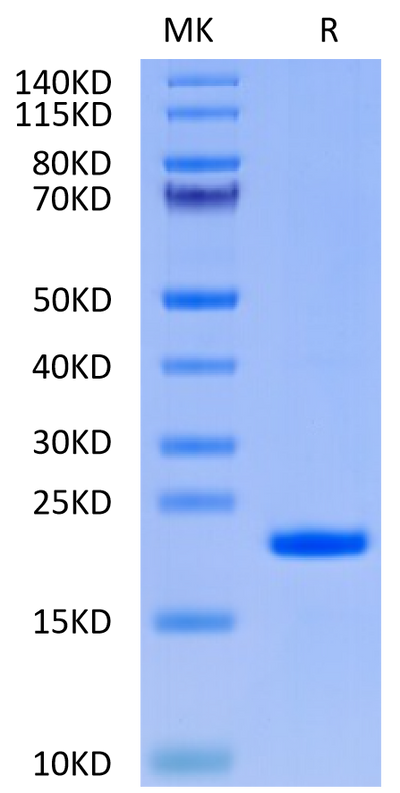 Human IL-37 on Tris-Bis PAGE under reduced condition. The purity is greater than 95%.Recombinant Human IL-37 Protein, Active