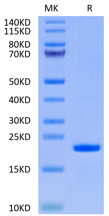 Human IL-37 on Tris-Bis PAGE under reduced condition. The purity is greater than 95%.Recombinant Human IL-37 Protein, Active