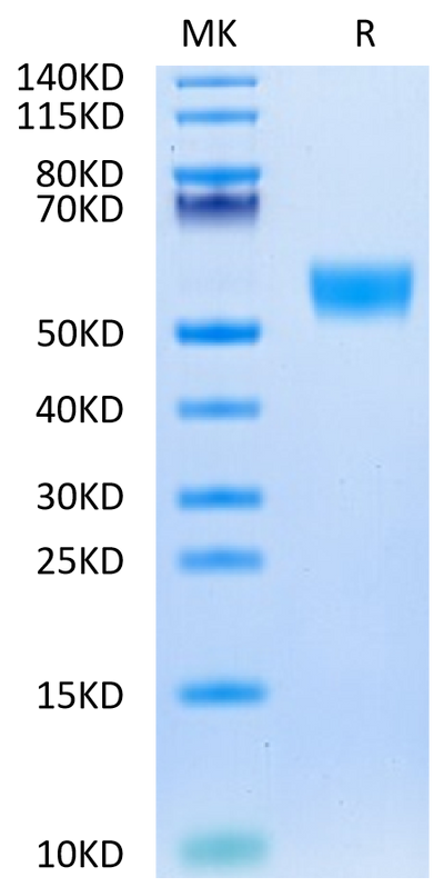 Biotinylated Mouse CD5 on Tris-Bis PAGE under reduced condition. The purity is greater than 95%.Biotinylated Mouse CD5 Protein (Primary Amine Labeling)