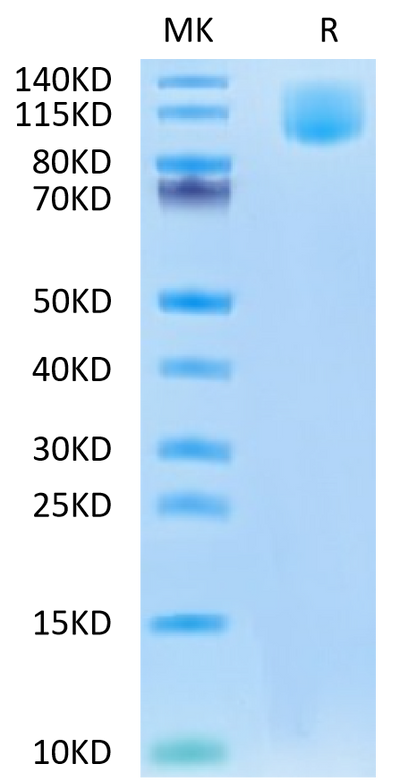 Human CA125 on Tris-Bis PAGE under reduced condition. The purity is greater than 95%.