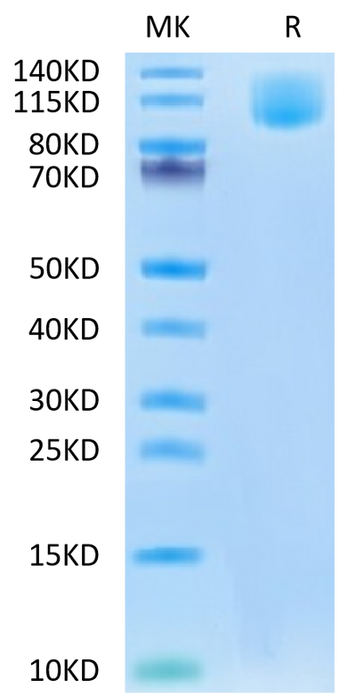 Human CA125 on Tris-Bis PAGE under reduced condition. The purity is greater than 95%.Recombinant Human CA125/MUC16 Protein, Active