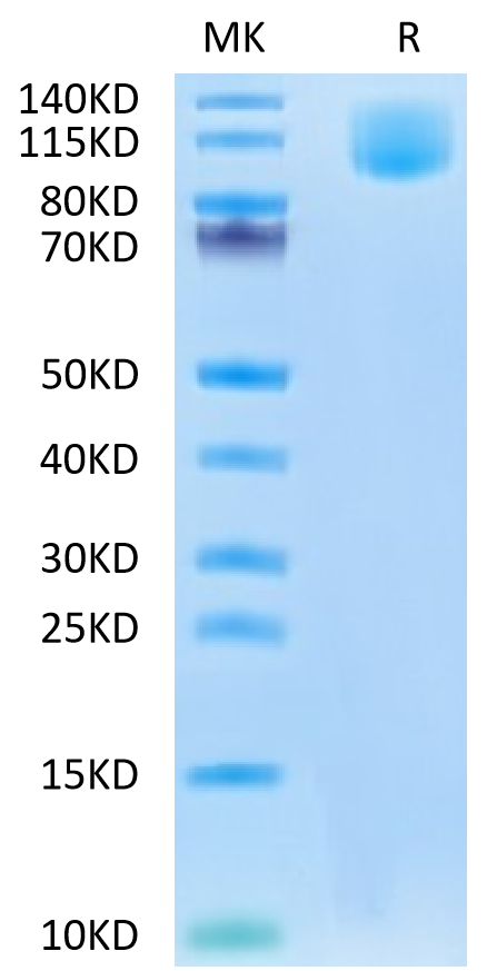 Human CA125 on Tris-Bis PAGE under reduced condition. The purity is greater than 95%.Recombinant Human CA125/MUC16 Protein, Active