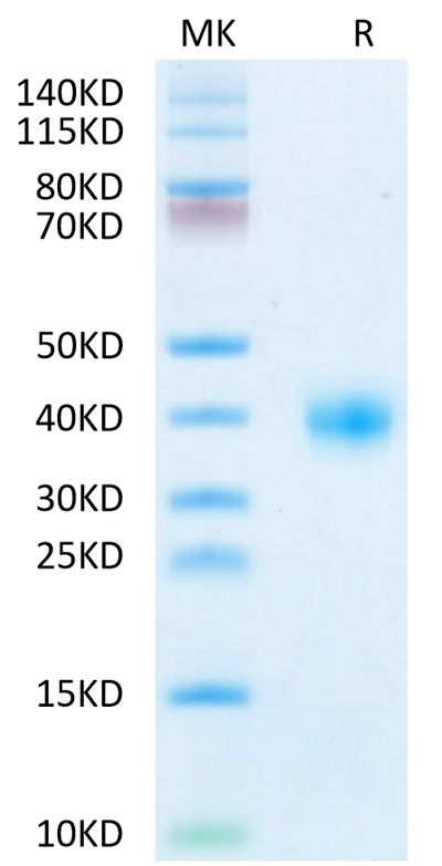 SARS-CoV-2 Spike RBD (Omicron XBB.1.5) on Tris-Bis PAGE under reduced condition. The purity is greater than 95%.Recombinant SARS-CoV-2 Spike RBD (Omicron XBB.1.5) Protein, Active