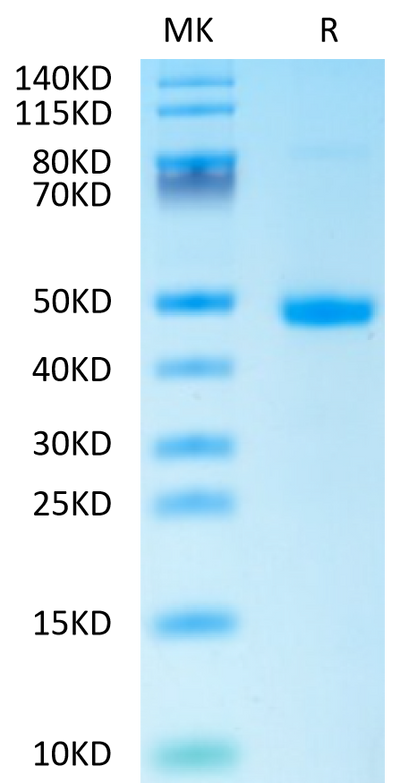 Human DKK1 C terminal Domain on Tris-Bis PAGE under reduced condition. The purity is greater than 95%.Recombinant Human DKK1 C terminal Domain Protein, Active