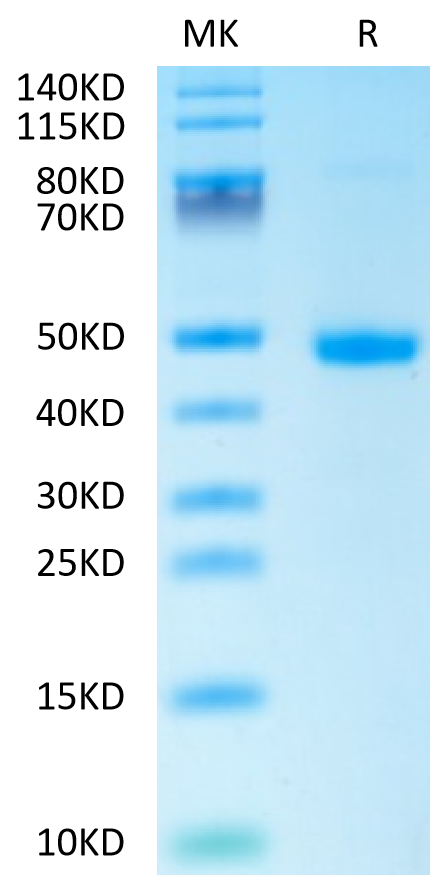 Human DKK1 C terminal Domain on Tris-Bis PAGE under reduced condition. The purity is greater than 95%.Recombinant Human DKK1 C terminal Domain Protein, Active