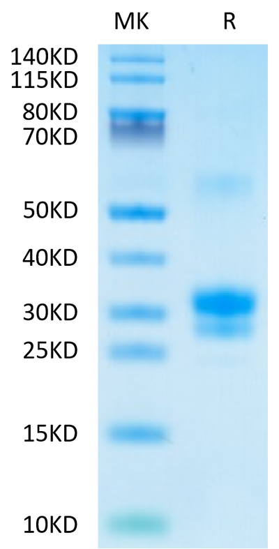 Human TNFSF15 on Tris-Bis PAGE under reduced condition. The purity is greater than 90%.Recombinant Human TNFSF15 Protein, Active