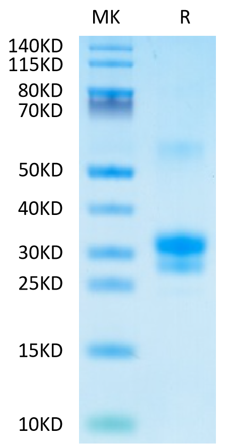 Human TNFSF15 on Tris-Bis PAGE under reduced condition. The purity is greater than 90%.Recombinant Human TNFSF15 Protein, Active