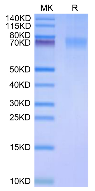 Human Siglec-10 (R119A) on Tris-Bis PAGE under reduced condition. The purity is greater than 95%.Recombinant Human Siglec-10 (R119A) Protein, Active